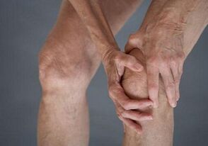 Aediosis and knee on their own