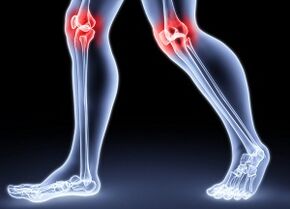 The reasons for the development of knee olis