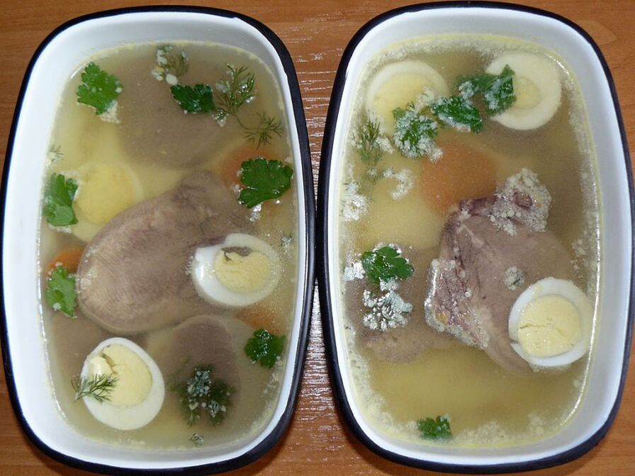 Aspic for knee anthrosis