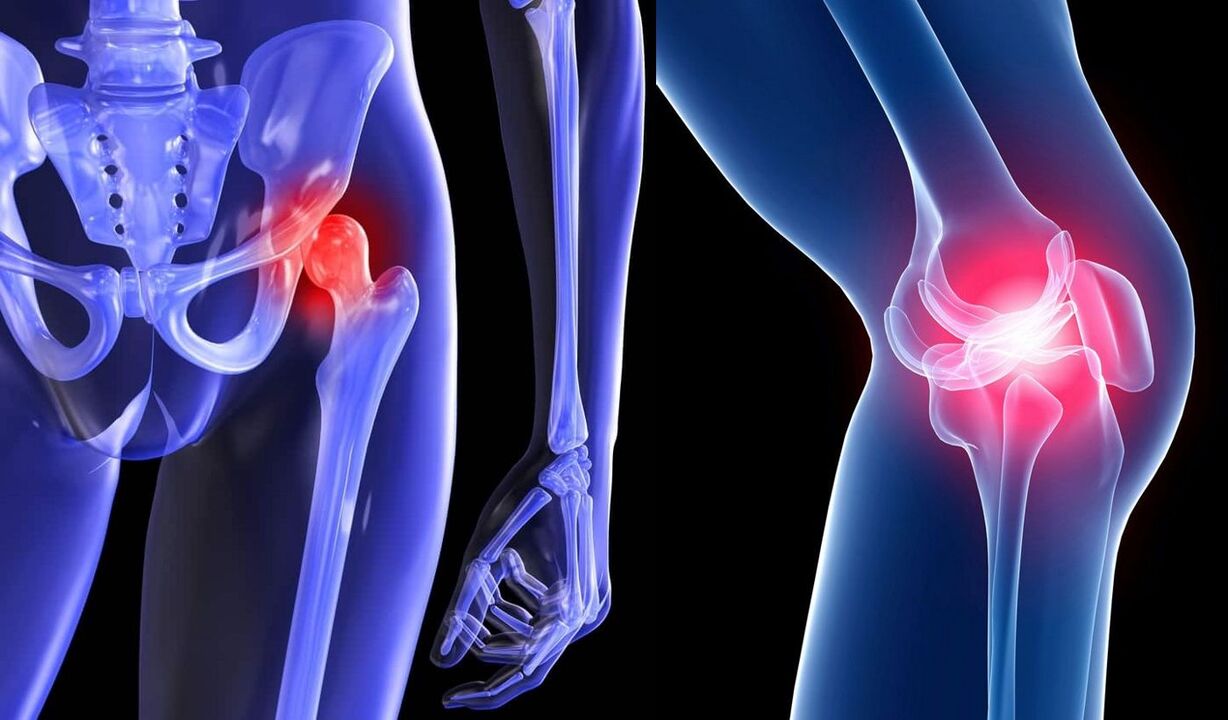 symptoms of joint disease